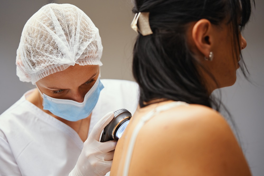 Dermatologist examines female patient's mole on her back. Medazur Medical Clinic in Leytonstone.