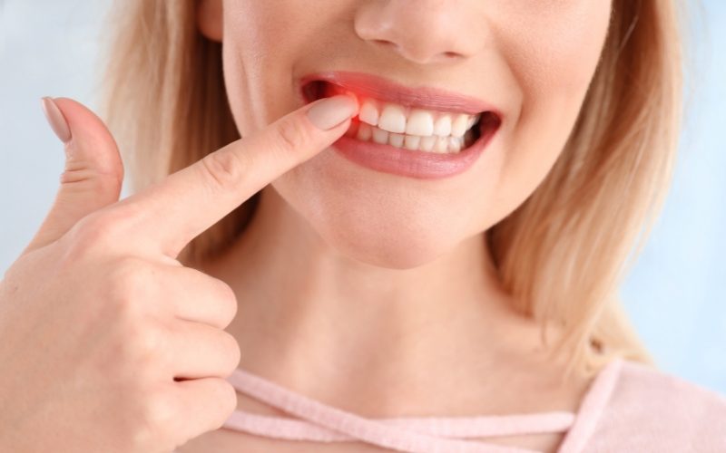 Female patient points to her gum inflammation with finger. Medazur Medical Clinic in Leytonstone.