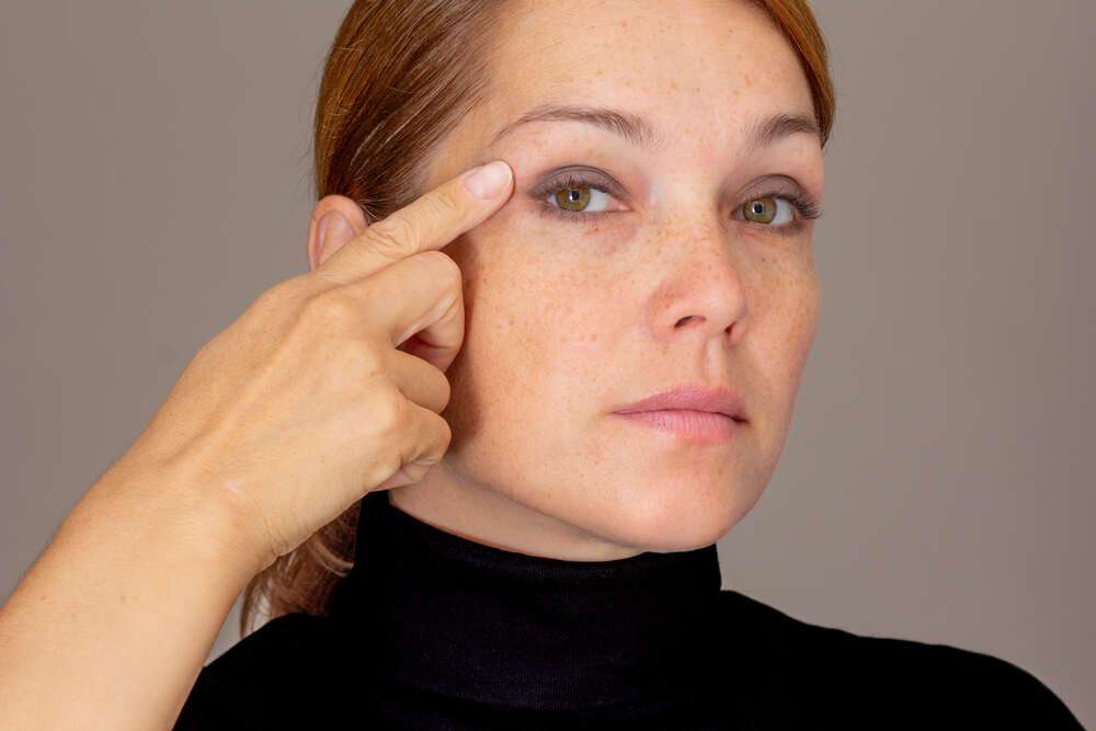Female Patient touching her face. Medazur Medical Clinic in Leytonstone.