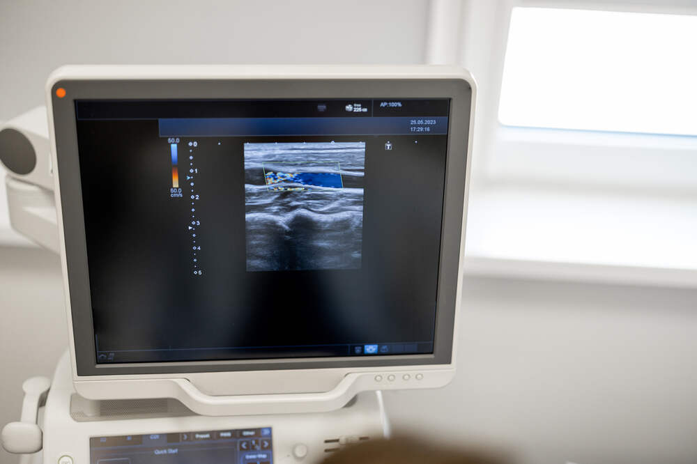 Ultrasound machine screen with examination onscreen. Medazur Medical Clinic in Leytonstone.