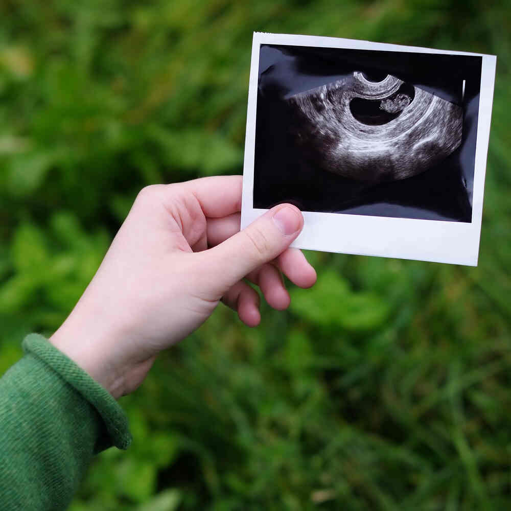 Woman holding foetus ultrasound photo. Medazur Medical Clinic in Leytonstone.